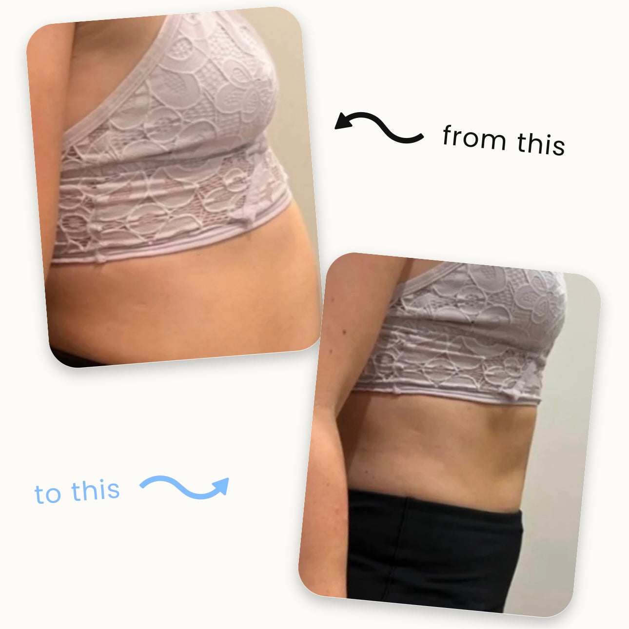 Natravor™ Slimming Patches 🍏|🔥 Fast Fat Burn & Metabolic Balance|Backed by Obesity Research Experts